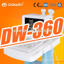 DW360 12''LED screen portable medical diagnostic equipment & portable sonoline scanner for sale